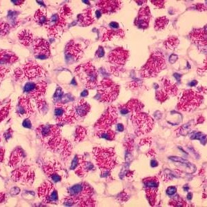 Mycobacterium